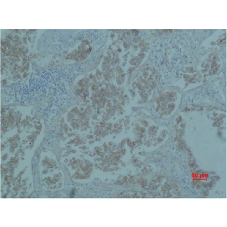 Immunohistochemistry - Catenin-β Monoclonal Antibody from Signalway Antibody (40487) - Antibodies.com