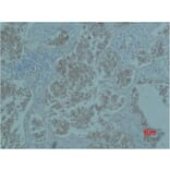 Immunohistochemistry - Catenin-β Monoclonal Antibody from Signalway Antibody (40487) - Antibodies.com