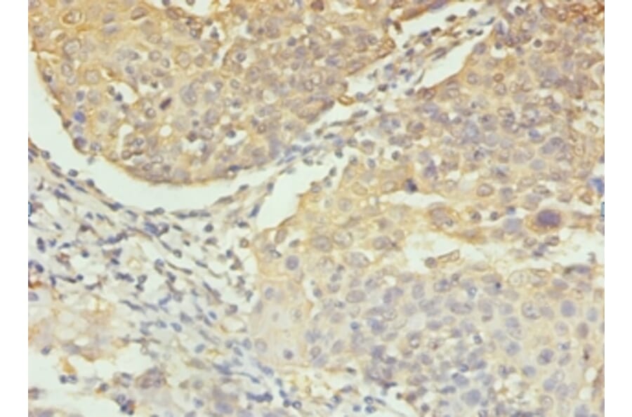 Immunohistochemistry - Caspase-3 Polyclonal Antibody from Signalway Antibody (42437) - Antibodies.com