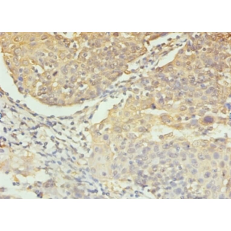Immunohistochemistry - Caspase-3 Polyclonal Antibody from Signalway Antibody (42437) - Antibodies.com