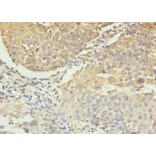 Immunohistochemistry - Caspase-3 Polyclonal Antibody from Signalway Antibody (42437) - Antibodies.com