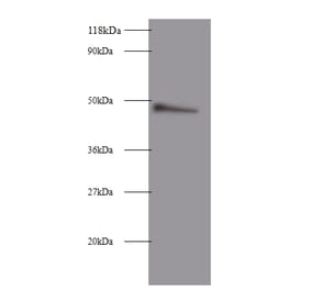 Clusterin Polyclonal Antibody from Signalway Antibody (42447) - Antibodies.com