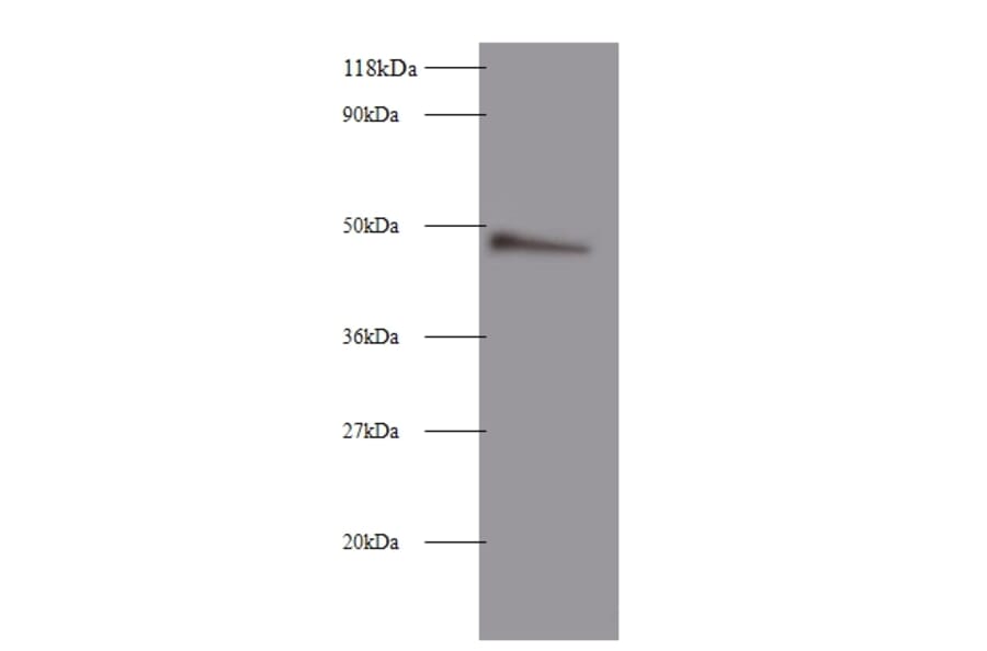 Clusterin Polyclonal Antibody from Signalway Antibody (42447) - Antibodies.com