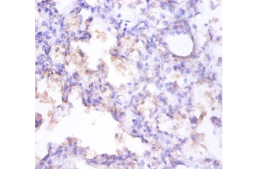 Immunohistochemistry - Clusterin Polyclonal Antibody from Signalway Antibody (42447) - Antibodies.com