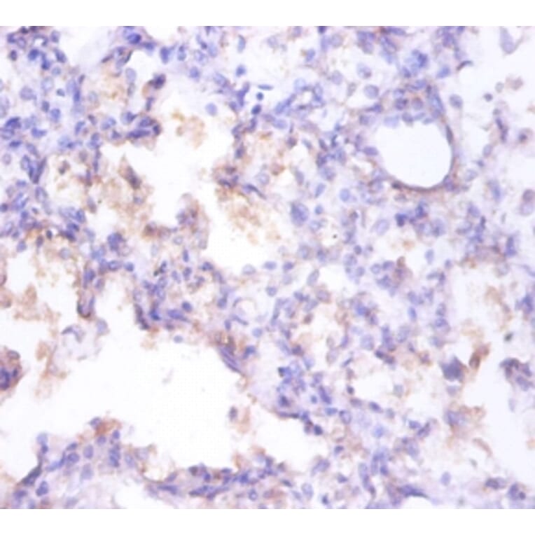 Immunohistochemistry - Clusterin Polyclonal Antibody from Signalway Antibody (42447) - Antibodies.com