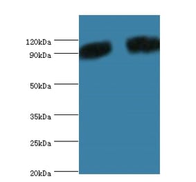 Periostin Polyclonal Antibody from Signalway Antibody (42516) - Antibodies.com