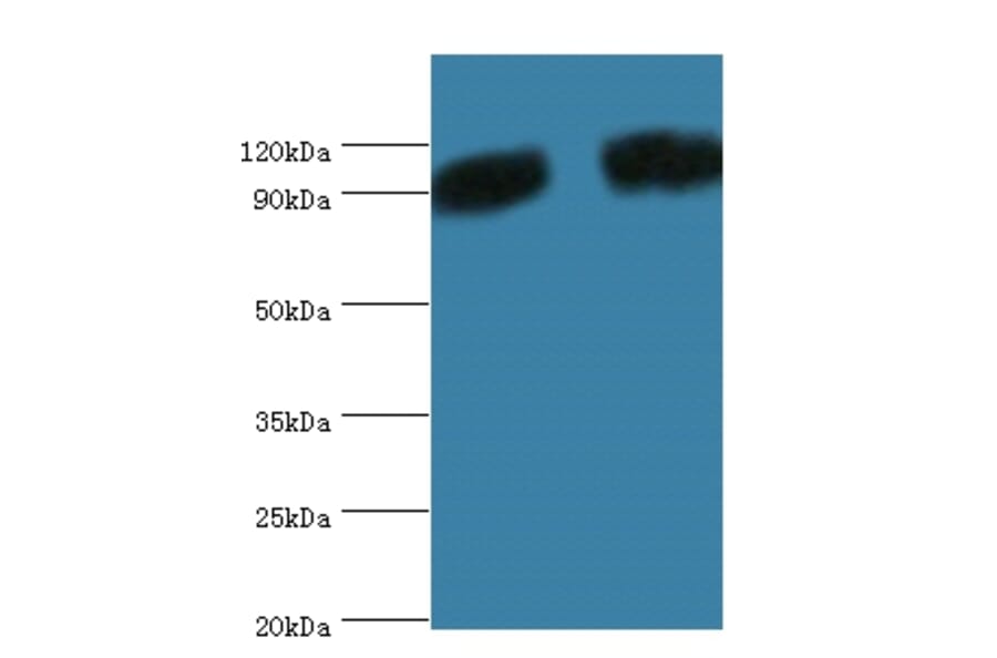 Periostin Polyclonal Antibody from Signalway Antibody (42516) - Antibodies.com
