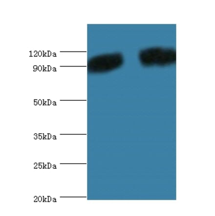 Periostin Polyclonal Antibody from Signalway Antibody (42516) - Antibodies.com