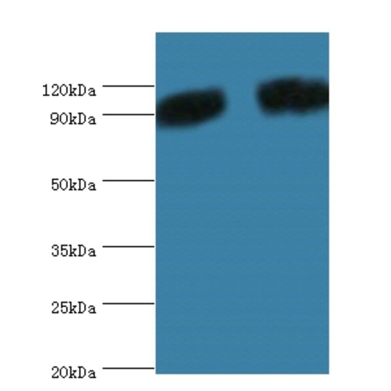 Periostin Polyclonal Antibody from Signalway Antibody (42516) - Antibodies.com