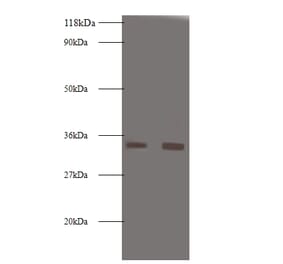 Trypsin-3 Polyclonal Antibody from Signalway Antibody (42559) - Antibodies.com