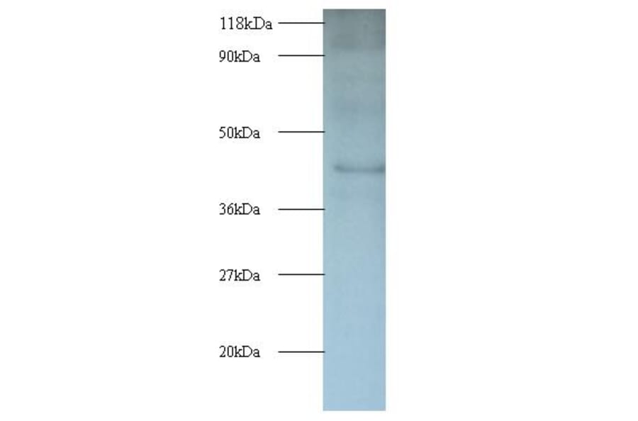 Interleukin enhancer-binding factor 2 Polyclonal Antibody from Signalway Antibody (42056) - Antibodies.com