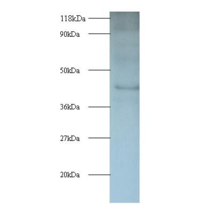 Interleukin enhancer-binding factor 2 Polyclonal Antibody from Signalway Antibody (42056) - Antibodies.com