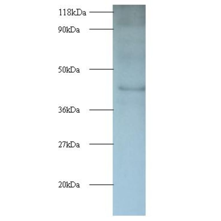 Interleukin enhancer-binding factor 2 Polyclonal Antibody from Signalway Antibody (42056) - Antibodies.com