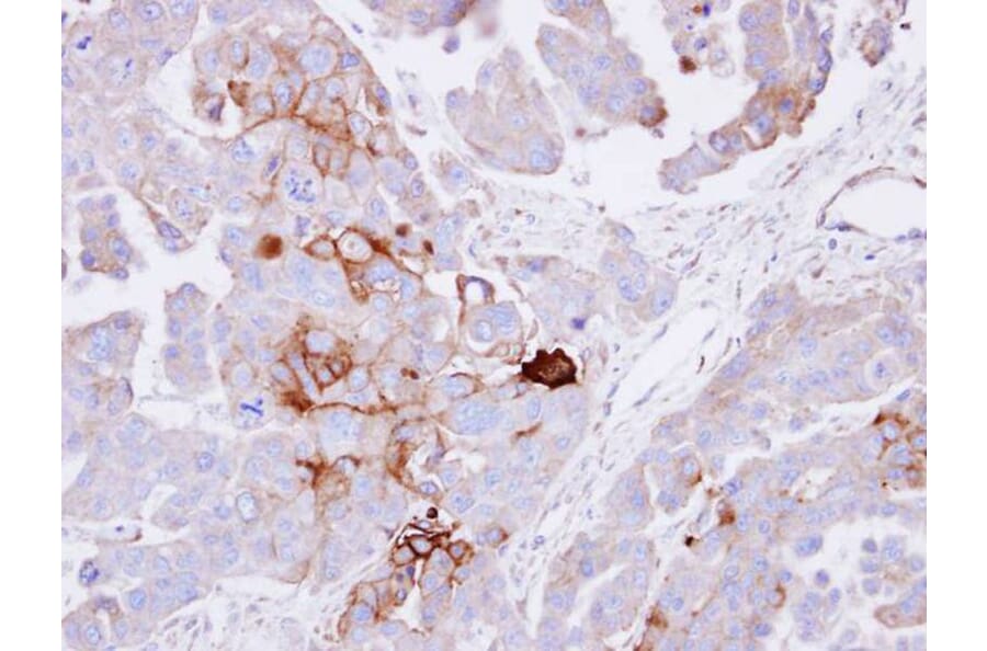 Immunohistochemistry - alkaline phosphatase (liver/bone/kidney) antibody from Signalway Antibody - Antibodies.com