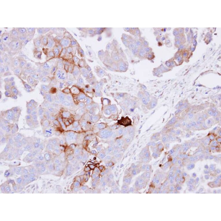 Immunohistochemistry - alkaline phosphatase (liver/bone/kidney) antibody from Signalway Antibody - Antibodies.com