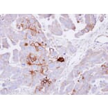 Immunohistochemistry - alkaline phosphatase (liver/bone/kidney) antibody from Signalway Antibody - Antibodies.com
