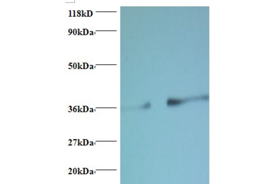 Phosphatidylserine synthase 1 Polyclonal Antibody from Signalway Antibody (42413) - Antibodies.com