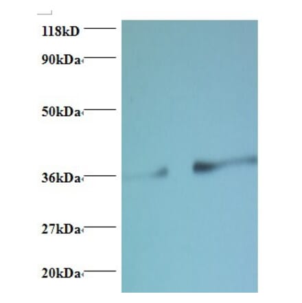 Phosphatidylserine synthase 1 Polyclonal Antibody from Signalway Antibody (42413) - Antibodies.com