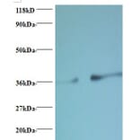 Phosphatidylserine synthase 1 Polyclonal Antibody from Signalway Antibody (42413) - Antibodies.com