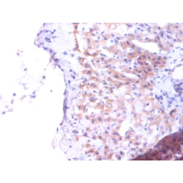 Immunohistochemistry - Phosphatidylserine synthase 1 Polyclonal Antibody from Signalway Antibody - Antibodies.com