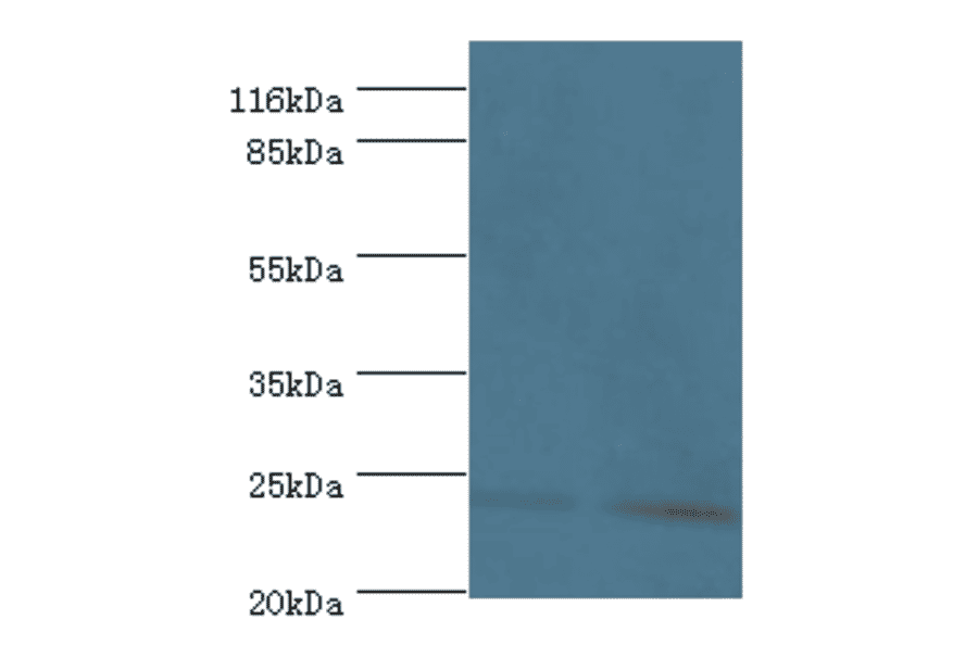 Metalloproteinase inhibitor 3 Polyclonal Antibody from Signalway Antibody (42548) - Antibodies.com