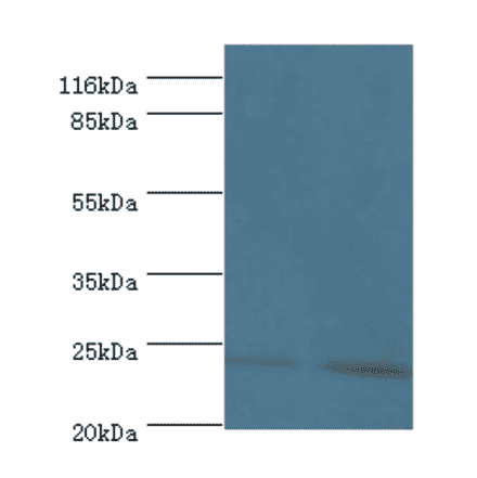 Metalloproteinase inhibitor 3 Polyclonal Antibody from Signalway Antibody (42548) - Antibodies.com