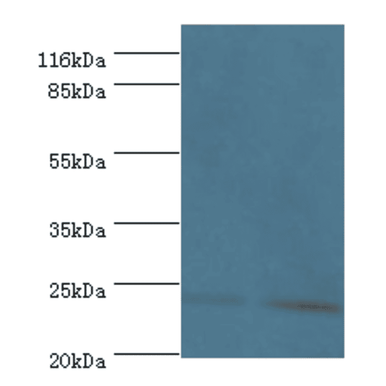 Metalloproteinase inhibitor 3 Polyclonal Antibody from Signalway Antibody (42548) - Antibodies.com