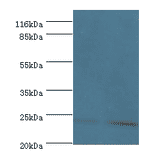 Metalloproteinase inhibitor 3 Polyclonal Antibody from Signalway Antibody (42548) - Antibodies.com
