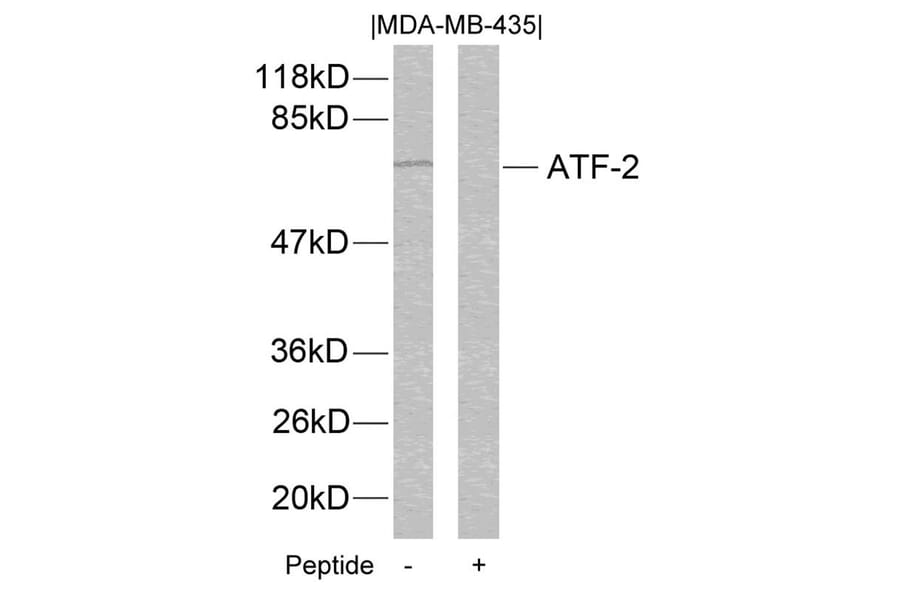 Western blot - ATF2 (Ab-112 or 94) Antibody from Signalway Antibody (21033) - Antibodies.com