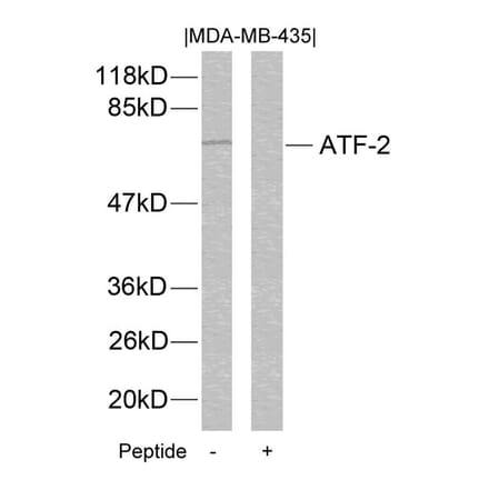 Western blot - ATF2 (Ab-112 or 94) Antibody from Signalway Antibody (21033) - Antibodies.com