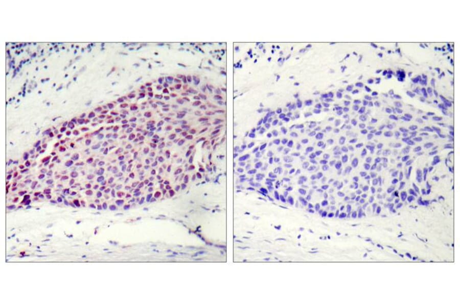 Immunohistochemistry - ATF2 (Ab-112 or 94) Antibody from Signalway Antibody (21033) - Antibodies.com