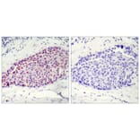 Immunohistochemistry - ATF2 (Ab-112 or 94) Antibody from Signalway Antibody (21033) - Antibodies.com