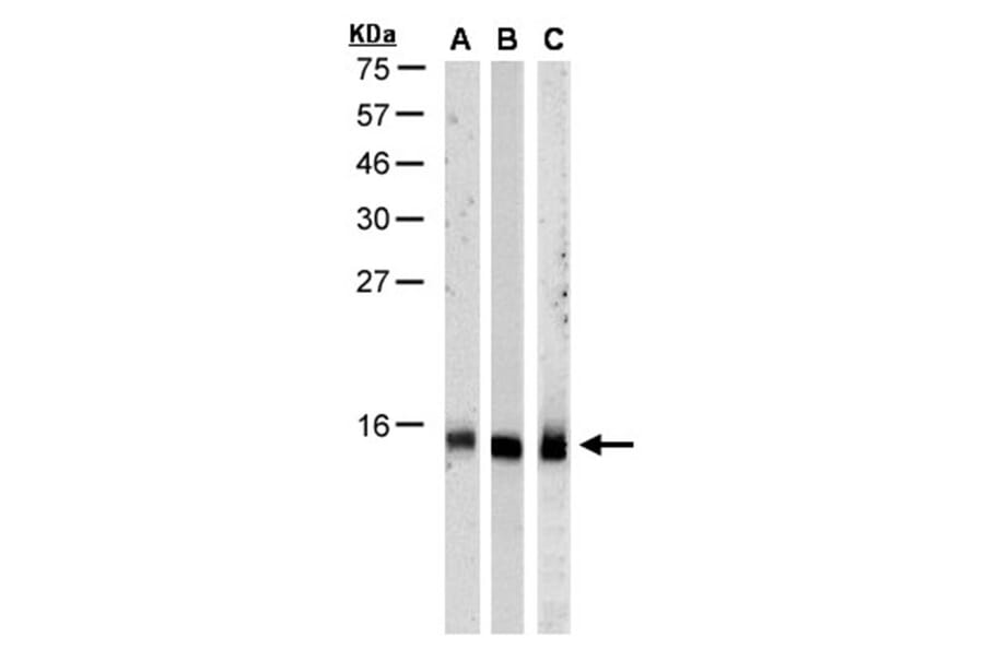 RPA 14 kDa subunit antibody from Signalway Antibody (22947) - Antibodies.com