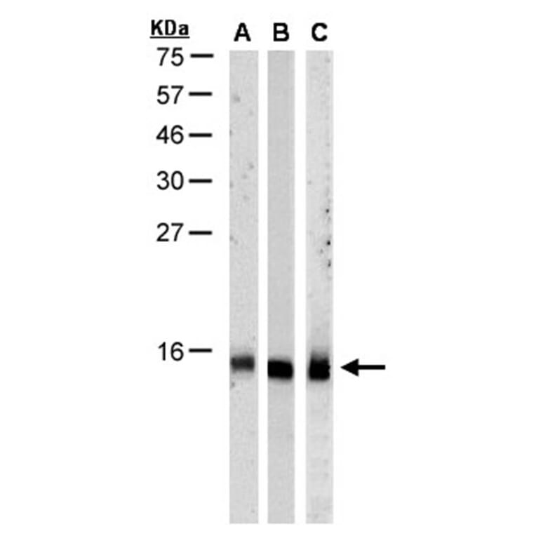 RPA 14 kDa subunit antibody from Signalway Antibody (22947) - Antibodies.com