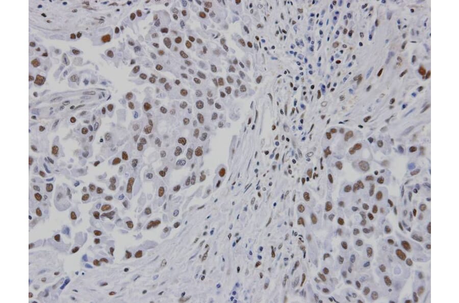 Immunohistochemistry - RPA 14 kDa subunit antibody from Signalway Antibody (22947) - Antibodies.com