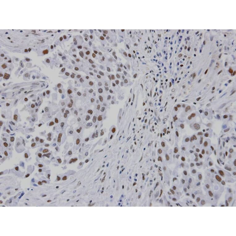 Immunohistochemistry - RPA 14 kDa subunit antibody from Signalway Antibody (22947) - Antibodies.com