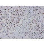 Immunohistochemistry - RPA 14 kDa subunit antibody from Signalway Antibody (22947) - Antibodies.com