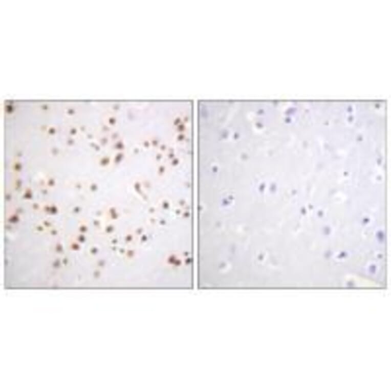 Immunohistochemistry - Catenin-δ1 (Ab-228) Antibody from Signalway Antibody (33157) - Antibodies.com