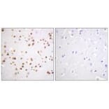 Immunohistochemistry - Catenin-δ1 (Ab-228) Antibody from Signalway Antibody (33157) - Antibodies.com