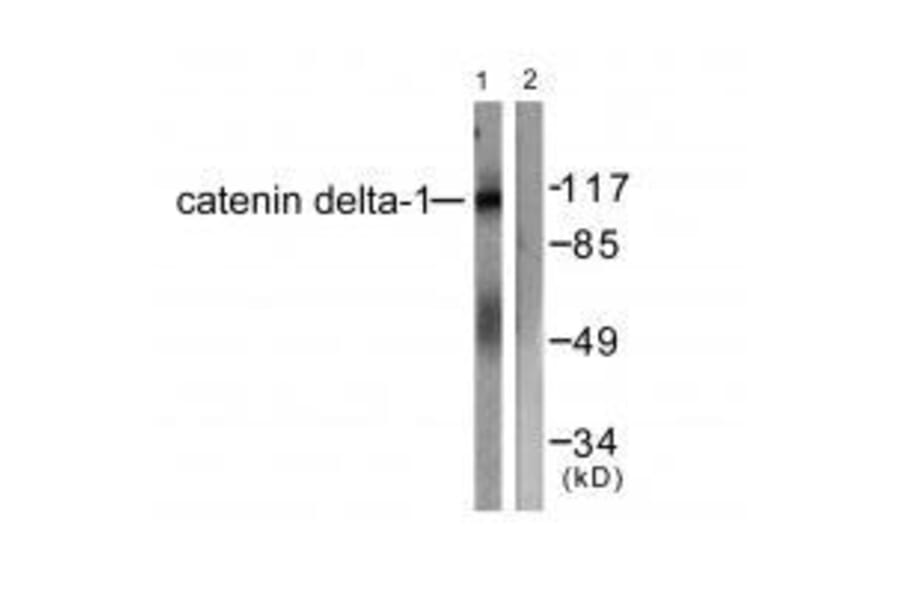 Western blot - Catenin-δ1 (Ab-228) Antibody from Signalway Antibody (33157) - Antibodies.com