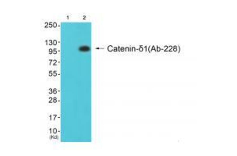 Western blot - Catenin-δ1 (Ab-228) Antibody from Signalway Antibody (33157) - Antibodies.com