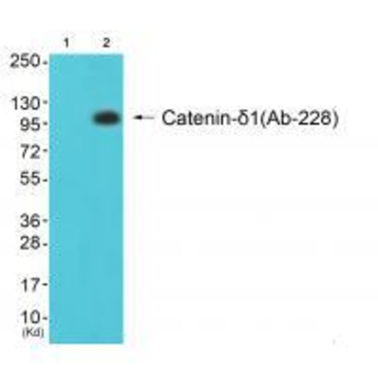 Western blot - Catenin-δ1 (Ab-228) Antibody from Signalway Antibody (33157) - Antibodies.com