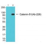Western blot - Catenin-δ1 (Ab-228) Antibody from Signalway Antibody (33157) - Antibodies.com