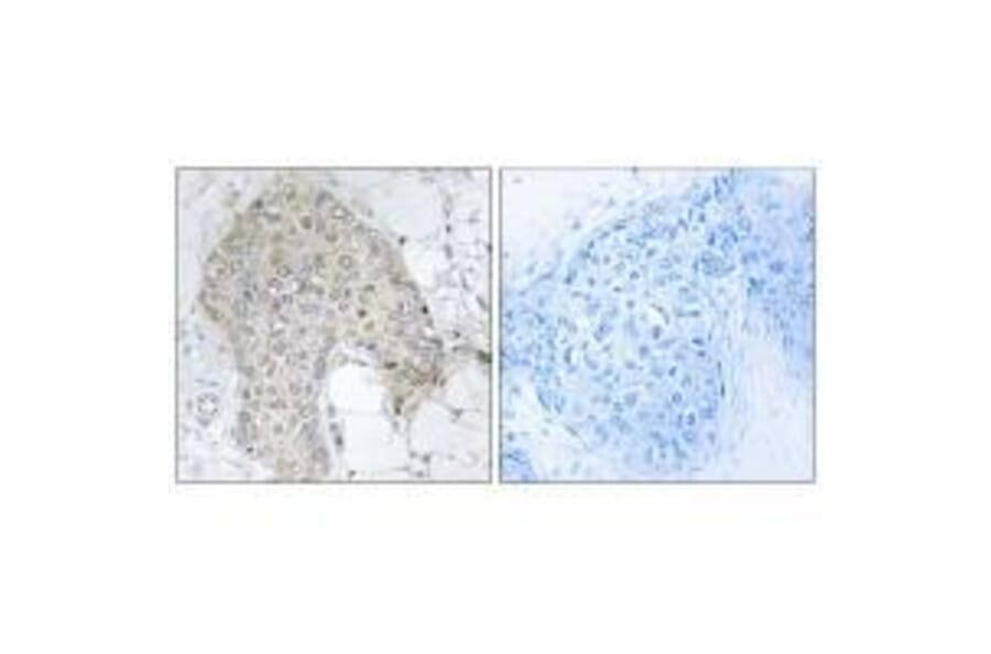Immunohistochemistry - PPP1R2 (Ab-120/121) Antibody from Signalway Antibody (33173) - Antibodies.com