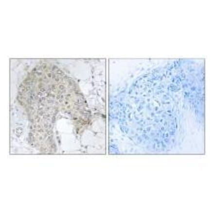 Immunohistochemistry - PPP1R2 (Ab-120/121) Antibody from Signalway Antibody (33173) - Antibodies.com