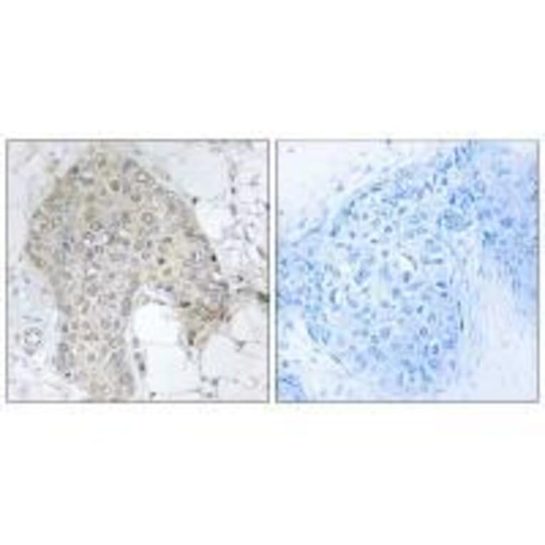 Immunohistochemistry - PPP1R2 (Ab-120/121) Antibody from Signalway Antibody (33173) - Antibodies.com