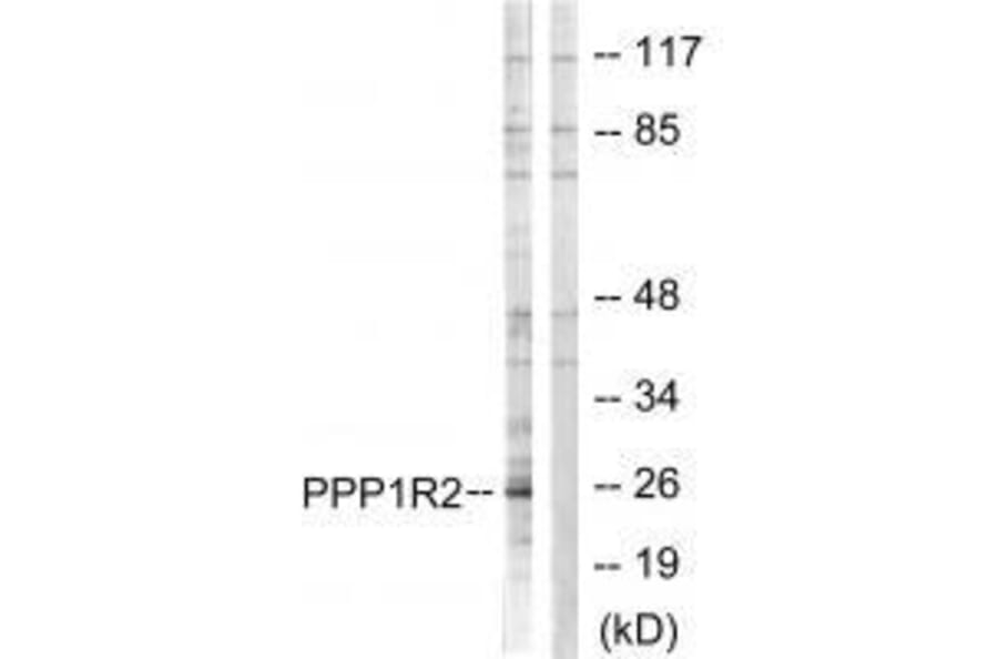 Western blot - PPP1R2 (Ab-120/121) Antibody from Signalway Antibody (33173) - Antibodies.com