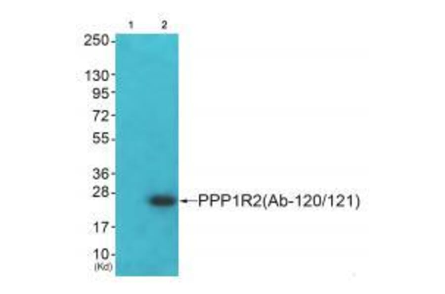 Western blot - PPP1R2 (Ab-120/121) Antibody from Signalway Antibody (33173) - Antibodies.com