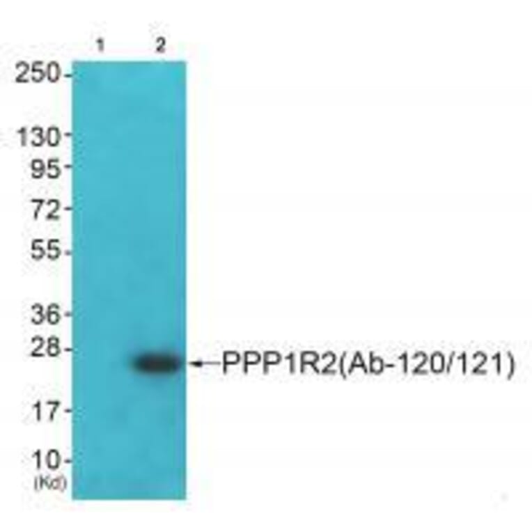 Western blot - PPP1R2 (Ab-120/121) Antibody from Signalway Antibody (33173) - Antibodies.com