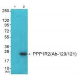 Western blot - PPP1R2 (Ab-120/121) Antibody from Signalway Antibody (33173) - Antibodies.com
